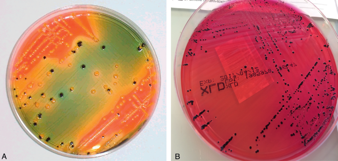 Salmonella spp