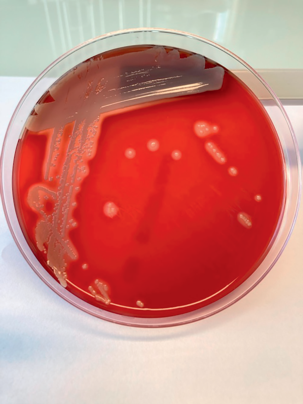 Staphylococcus aureus – AEMiP