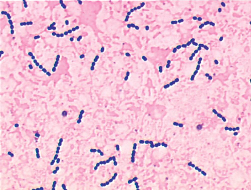 Streptococcus agalactiae – AEMiP