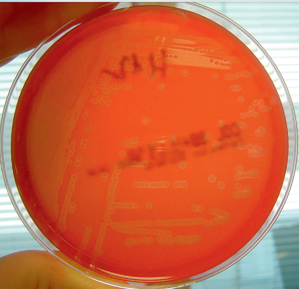 Coloration De Gram Du Streptocoque Du Groupe A Les Cocci Gram