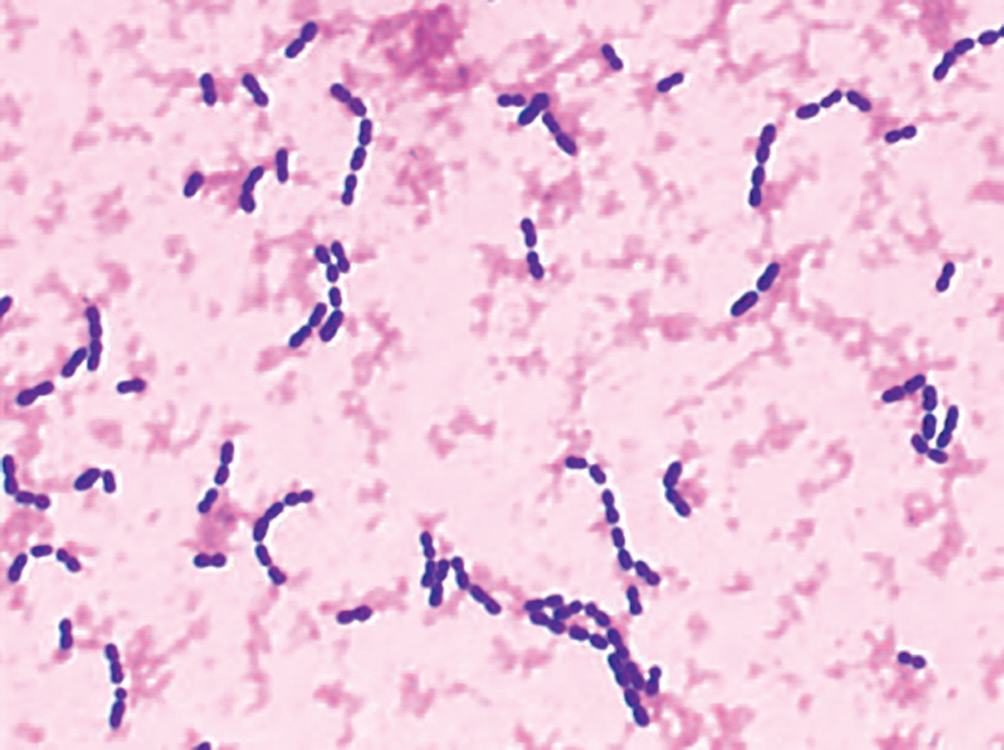 Streptococcus pneumoniae – AEMiP